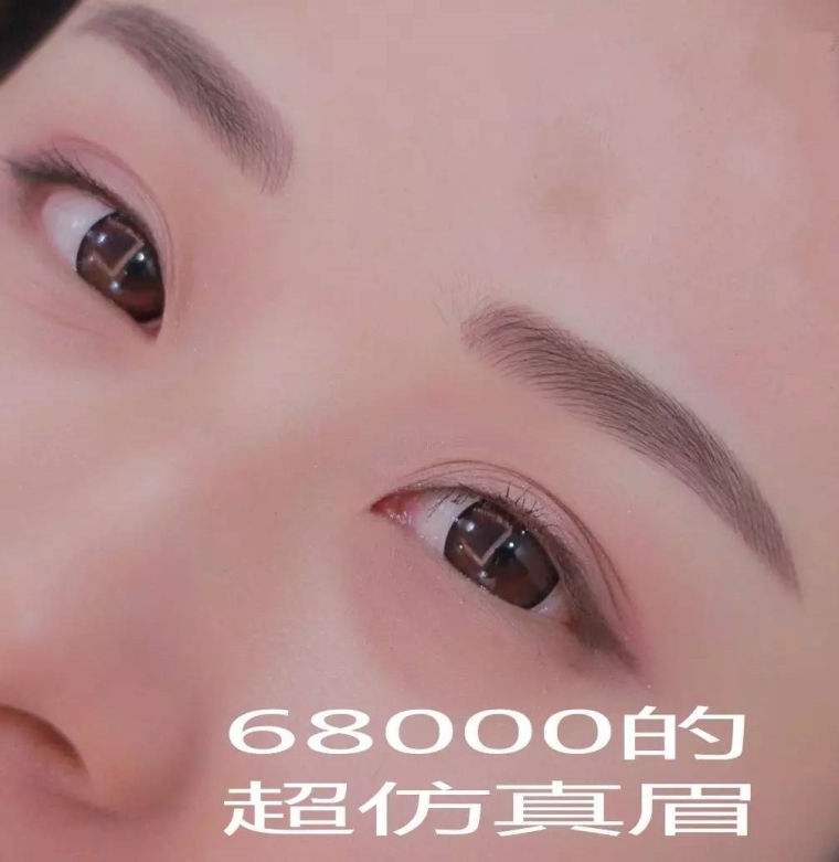 北京整形医院的医师告诉你洗眉要多少钱?