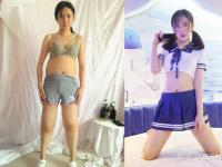 大神告诉你南京做抽脂瘦身多少钱