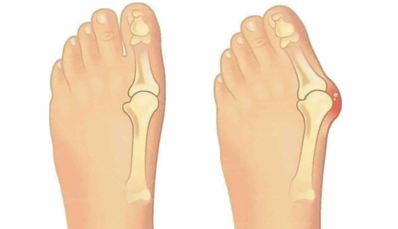 北京马文足科整形怎么样.jpg 北京马文足科整形怎么样.jpg