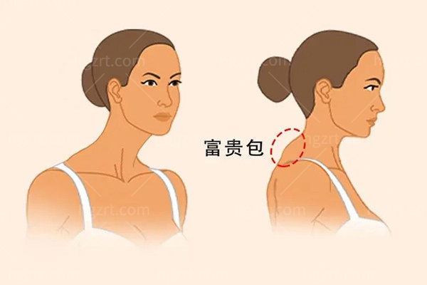 重庆光正整形 重庆光正整形