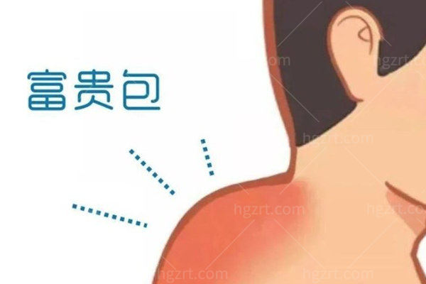 富贵包卡通图片 富贵包卡通图片