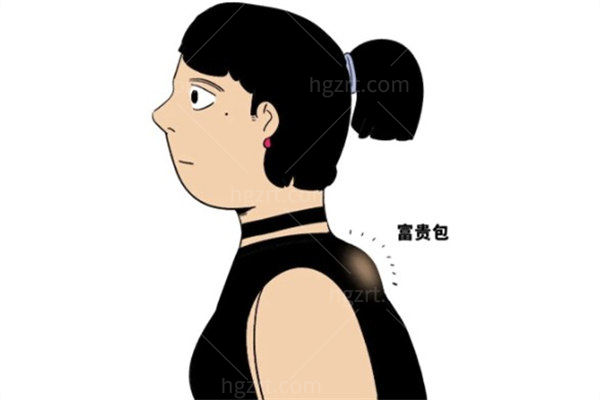 富贵包卡通图片 富贵包卡通图片