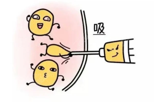上海哪家医院做抽脂手术好 总的来说这几家吸脂技术都不错 上海哪家医院做抽脂手术好 总的来说这几家吸脂技术都不错