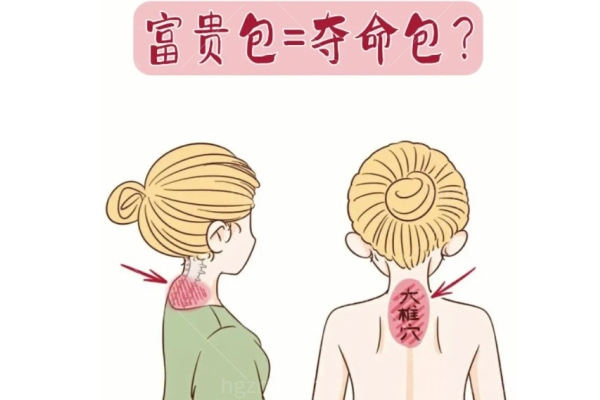 什么是“富贵包” 什么是“富贵包”