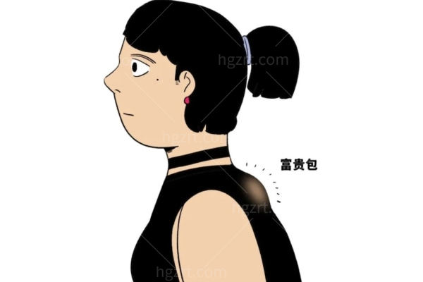 做富贵包手术有危险吗 做富贵包手术有危险吗