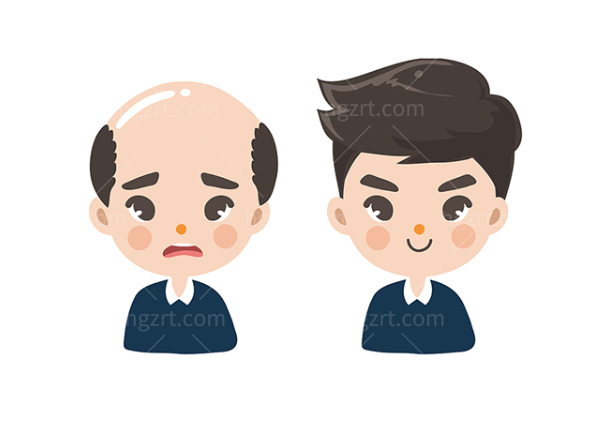 植发对比图 植发对比图