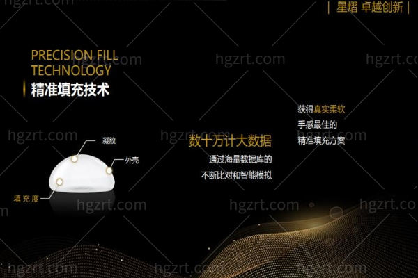 曼托和傲诺拉哪种好大概多少钱 曼托和傲诺拉哪种好大概多少钱