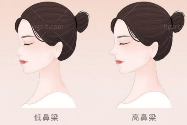 鼻部对比 鼻部对比