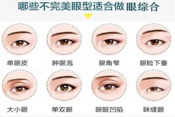 眼综合手术包括什么项目多少钱?关于眼部整形你还是只知道双眼皮手术吗