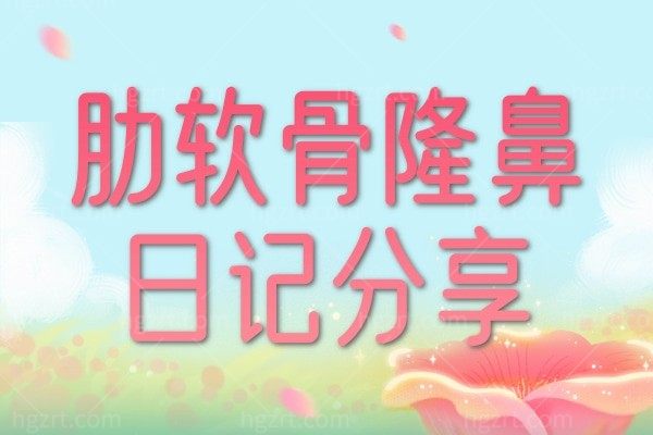 我的肋软骨隆鼻日记分享,虽然很遭罪但是终于摆脱了我的大蒜鼻