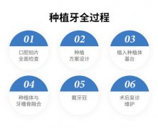 种植牙齿会对人体产生哪些危害