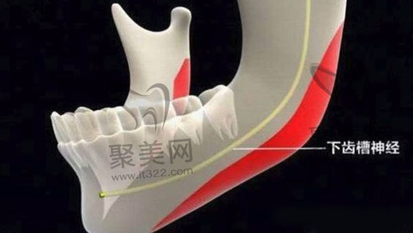 做完下颌角手术感觉没变化 做完下颌角手术感觉没变化