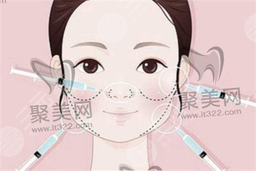 苹果肌填充 苹果肌填充