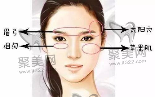 苹果肌填充 苹果肌填充