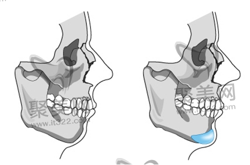 面部轮廓 面部轮廓