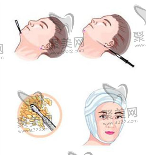 面部轮廓 面部轮廓