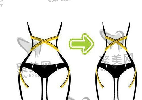 腰腹环吸 腰腹环吸