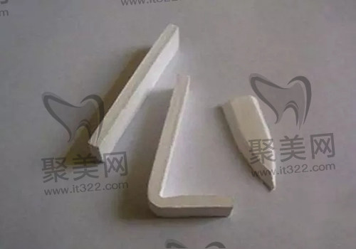 膨体假体 膨体假体