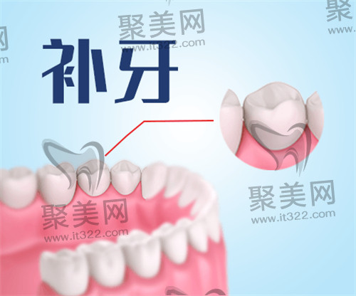牙齿健康 牙齿健康