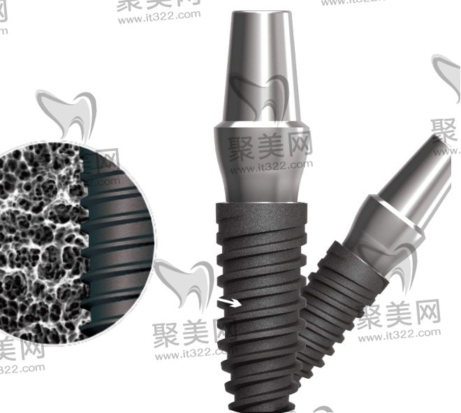 种植牙内部细节 种植牙内部细节
