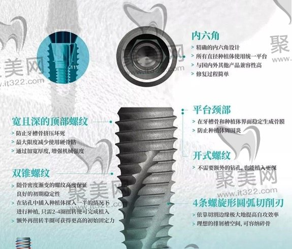 种植体优势 种植体优势