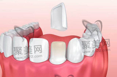 1675934915836160.jpg 3.jpg