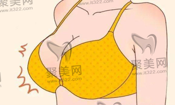 南京美莱24小时极速丰胸 南京美莱24小时极速丰胸