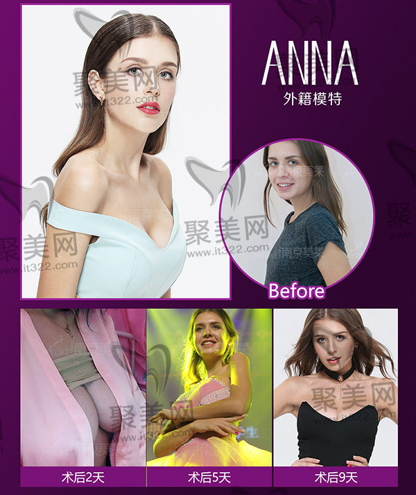 24小时极速丰胸 24小时极速丰胸