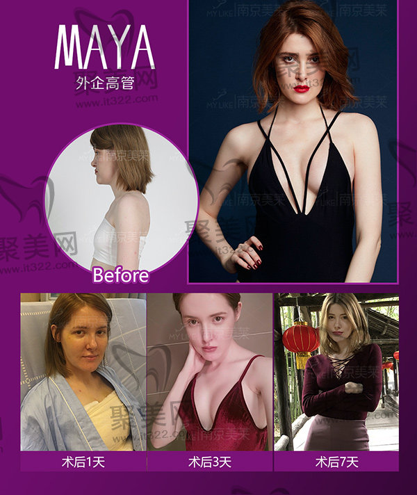 24小时极速丰胸 24小时极速丰胸