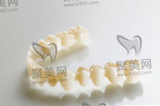 全瓷牙 全瓷牙