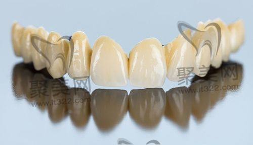 全瓷牙 全瓷牙