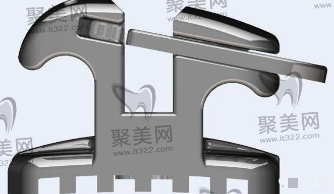 自锁托槽矫正好不好 自锁托槽矫正好不好