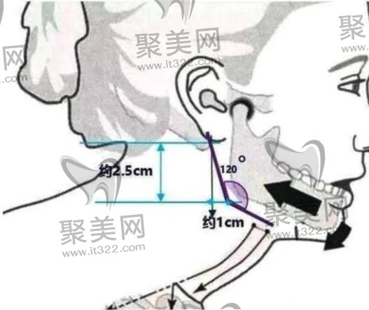 方脸削骨 方脸削骨