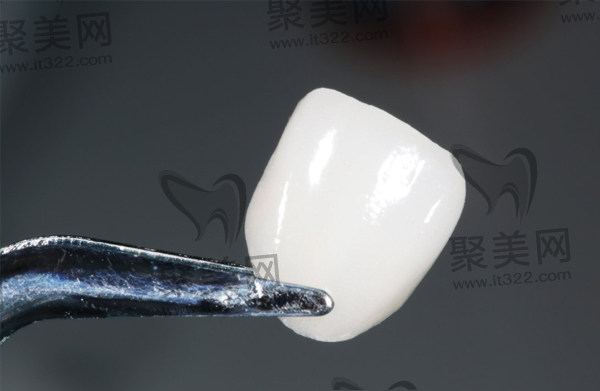 牙齿贴面材料展示 牙齿贴面材料展示