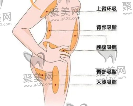 吸脂后多久可以二次吸脂? 吸脂后多久可以二次吸脂?
