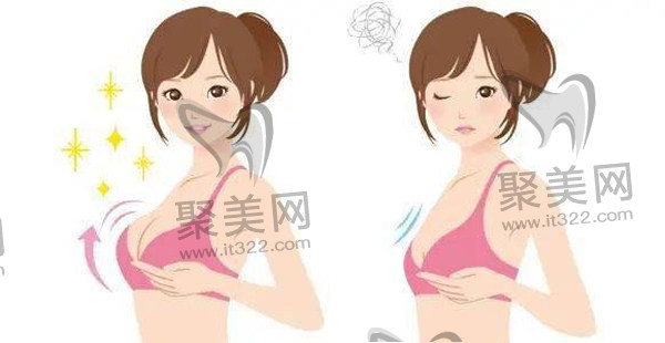 北京煤医王驰医生隆胸怎么样 北京煤医王驰医生隆胸怎么样