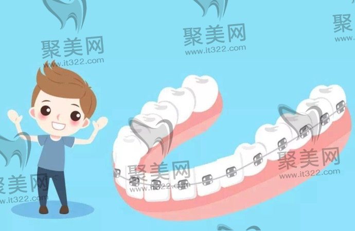 牙齿矫正好不好 牙齿矫正好不好