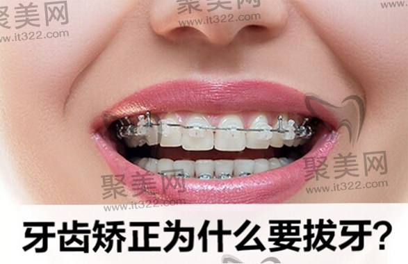 牙齿矫正必须要拔牙好还是不拔好 牙齿矫正必须要拔牙好还是不拔好