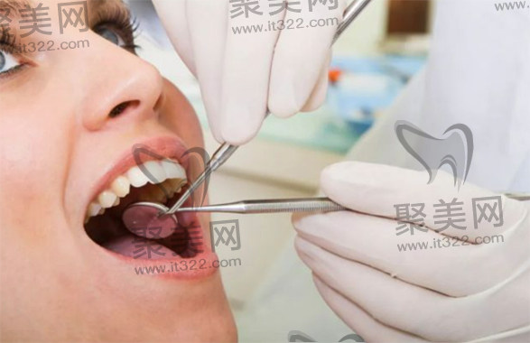 口腔检查 口腔检查