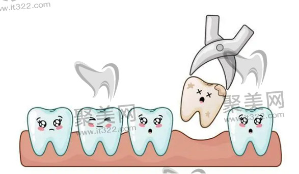 牙齿矫正必须要拔牙好还是不拔好 牙齿矫正必须要拔牙好还是不拔好