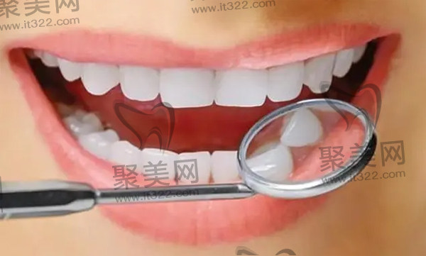 牙齿矫正治疗流程 牙齿矫正治疗流程