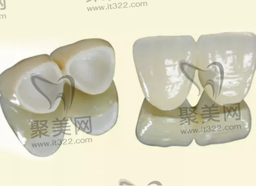 不同地区做全瓷牙价格也不同 不同地区做全瓷牙价格也不同