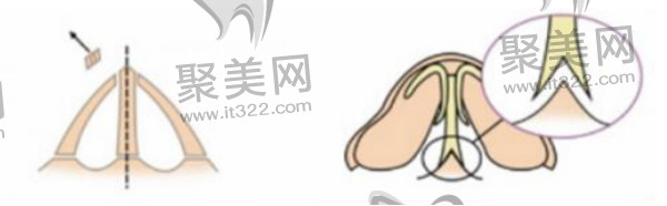 北京煤医医疗美容医院 北京煤医医疗美容医院