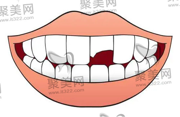 门牙断了一半还能长出来吗 门牙断了一半还能长出来吗