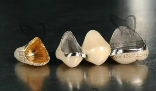 烤瓷牙的优缺点 烤瓷牙的优缺点