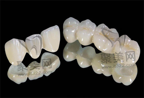 全瓷牙 全瓷牙