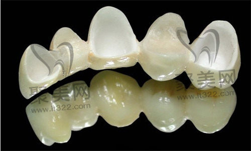 全瓷牙 全瓷牙