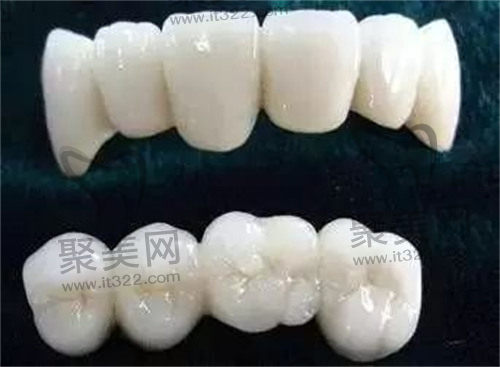 全瓷牙 全瓷牙