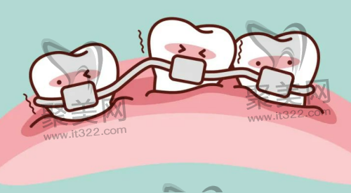 为什么做完牙齿矫正后悔了 为什么做完牙齿矫正后悔了