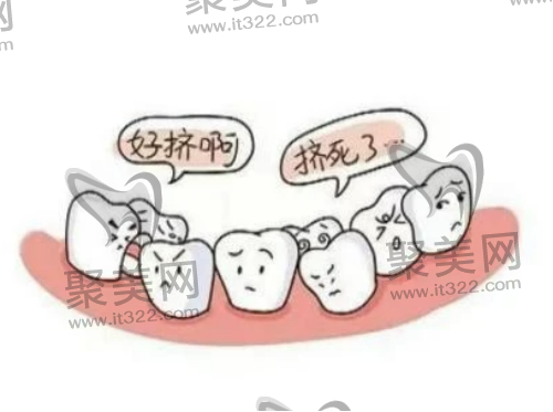 矫正牙齿之前要拔牙 矫正牙齿之前要拔牙